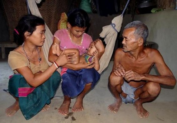 Fresh cases of malaria create havoc for the people in hilly areas: Center sends protocol to prevent the outbreak Fresh cases of malaria create havoc for the people in hilly areas: Center sends protocol to prevent the outbreak